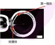做试管代孕的年龄,
              国内哪里有能未婚冻卵的正规医院？